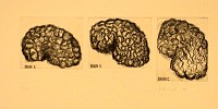 Brain