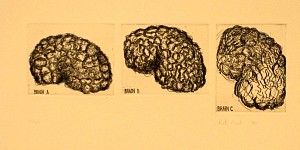 Brain
